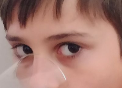 Oči